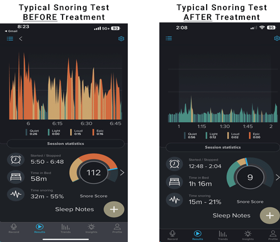 Snoring Verification on a Cell Phone APP Before and After